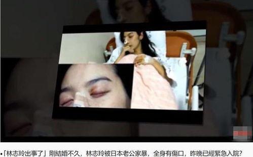 台媒爆料林志玲婚变新闻,台媒曝女神婚姻疑云笼罩